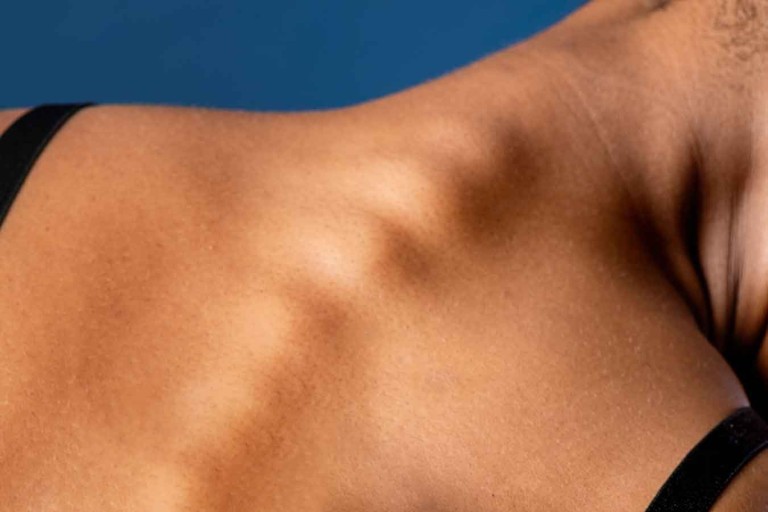 Comprensión de la subluxación vertebral y los beneficios de la atención quiropráctica cervical superior